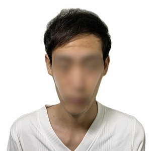 薄毛をカバーするために伸ばし続けた髪の毛、それが薄毛を強調させてしまう原因に！！