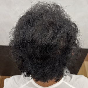 周りの髪で頭頂部をカバー。癖毛を活かしておしゃれなパーマ風スタイルに変身！