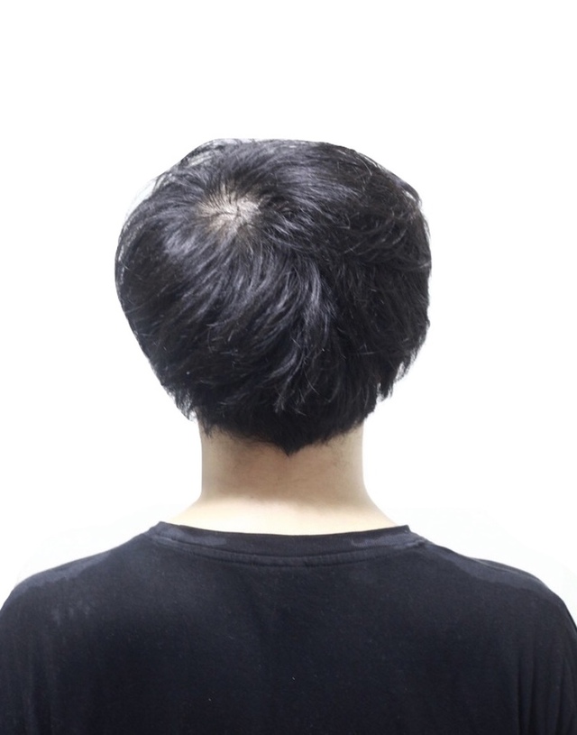 割れやすい 頭頂部 はつむじの位置を変えてしっかりカバー 悩み別ヘアカタログ 薄毛に悩む男性の為の美容院 Inti インティ 全席個室 東京 大阪 福岡に展開