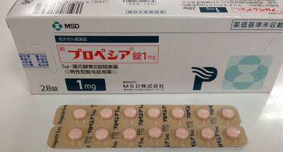 薄毛治療薬「プロペシア」