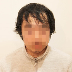 Inti Report 宮本 洋平 薄毛に悩む男性の為の美容院 Inti インティ 全席個室 東京 大阪 福岡に展開