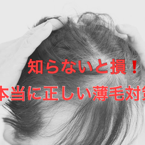 【薄毛　対策】今の薄毛予防で大丈夫？正しい対策をしましょう！