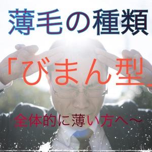 【びまん性脱毛症　薄毛】〜男女に多い『びまん性脱毛症』・おすすめアイテム！〜