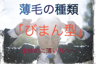 【びまん性脱毛症　薄毛】〜男女に多い『びまん性脱毛症』・おすすめアイテム！〜