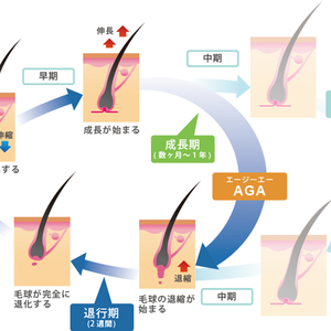 【薄毛　AGA】ヘアサイクルを知りベストの髪型をキープしよう！