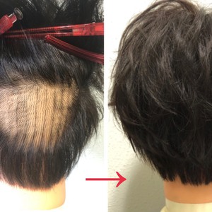 【植毛後　Ⅿ字】ヘアシート不要、NEWスタイル提案！