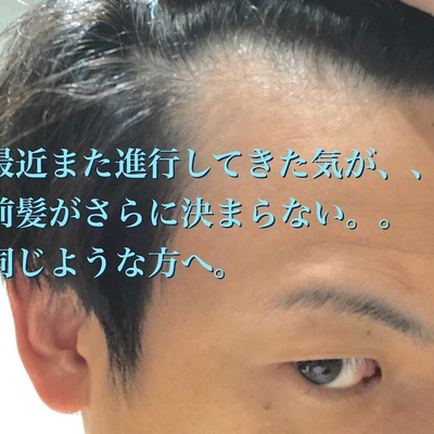 薄毛 スタイル どうしても前髪が薄く見える それは前髪だけのせいではない Inti Report 薄毛に悩む男性の為の美容院 Inti インティ 全席個室 東京 大阪 福岡に展開 薄毛 スタイル どうしても前髪が薄く見える それは前髪だけのせいではない Inti Report 薄毛に悩む男性の為の美容院 Inti インティ 全席個室 東京 大阪 福岡に展開