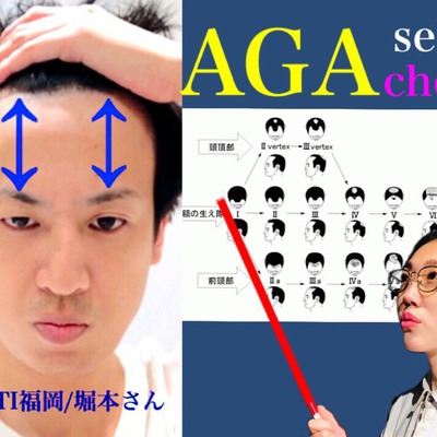 薄毛 診断 やってみよう 薄毛セルフチェック ٩ W و Inti Report 薄毛に悩む男性の為の美容院 Inti インティ 全席個室 東京 大阪 福岡に展開