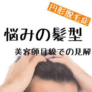 【円形脱毛症　髪型の悩み】実際のところどうなのかお伝えします