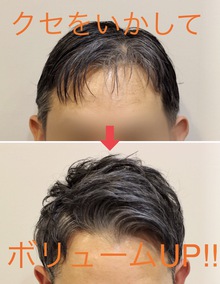 【薄毛　頭頂部】クセを見極めカットすることで複数の悩みを解消させるヘアデザインに