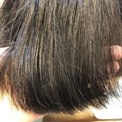 薄毛 セット スプレーが原因の フレーキング おこしてませんか Inti Report 薄毛に悩む男性の為の美容院 Inti インティ 全席個室 東京 大阪 福岡に展開 薄毛 セット スプレーが原因の フレーキング おこしてませんか Inti Report 薄毛に悩む男性の為の美容院 Inti インティ 全席個室 東京 大阪 福岡に展開
