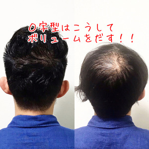 【O字型　パーマ】薄毛の頭頂部をカバーする方法！
