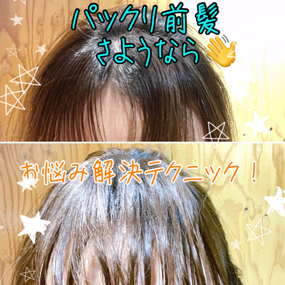 前髪 割れ 前髪が割れちゃう お悩みの女性の方へ Inti Report 薄毛に悩む男性の為の美容院 Inti インティ 全席個室 東京 大阪 福岡に展開 前髪 割れ 前髪が割れちゃう お悩みの女性の方へ Inti Report 薄毛に悩む男性の為の美容院 Inti インティ 全席個室 東京 大阪 福岡に展開