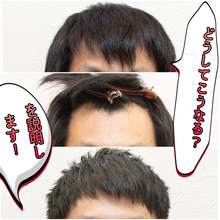 【男性　髪型】AGA（男性型脱毛症）と薄毛カバーカット