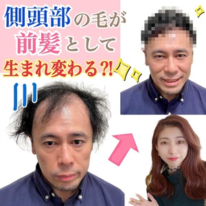 【薄毛　髪型】側頭部の髪の毛が前髪として生まれ変わる⁈