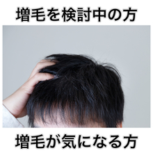 【増毛　結毛】増毛をご検討中の方はまずご相談を！！