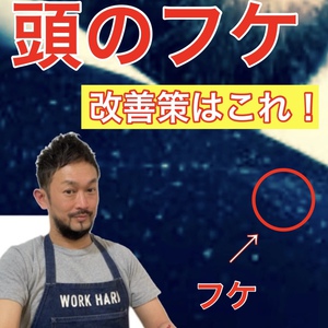 【薄毛・フケ】気になる頭皮の白い粉のような物！これって薄毛のサイン？