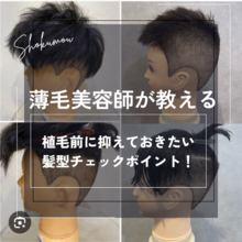 薄毛美容師が教える！  植毛するなら抑えたい