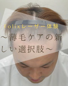 【薄毛　治療】 Folixレーザー体験、新しい選択肢