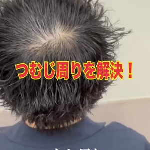 【つむじ周り　ヘアセット】つむじ周りの割れが気になるヘアセット