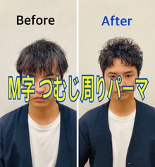 【Ｍ字 つむじ周り】前頭部 頭頂部 カバーするパーマ