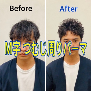 【Ｍ字 つむじ周り】前頭部 頭頂部 カバーするパーマ