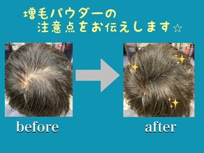 【薄毛　O字】増毛パウダーの注意点をレポートします☆