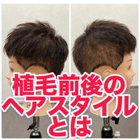 【植毛　髪形】　植毛後の髪型 メンズ向け前後カット解説｜INTI