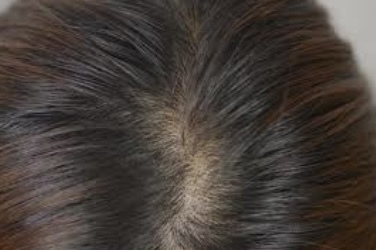 頭皮 カバー 美容師目線 ヘアタトゥーについて Inti Report 薄毛に悩む男性の為の美容院 Inti インティ 全席個室 東京 大阪 福岡に展開
