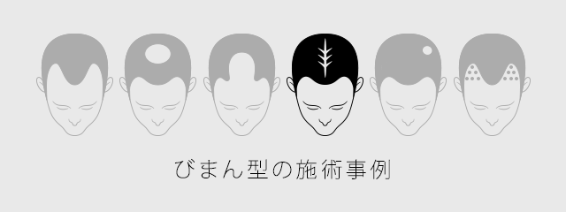 びまん型の施術事例